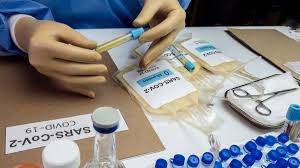 He also serves as the ceo of cole diagnostics, which has processed over 100,000 coronavirus tests. Plasma Therapy Available For Covid Patients Dhr Health Involved In Mayo Clinic Coordinated Study Using Plasma To Treat Patients With Covid 19 Texas Border Business