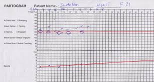 Das partogramm wird in der geburtshilfe dazu benutzt, zu erkennen, ob es sich um einen normalen geburtsverlauf handelt und ob. Partogram Obstetrics
