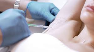 Underarm Area Issues Dr Ahmet Karacam Nisantasi