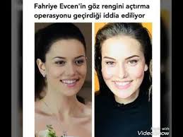 Fahriye Evcen In Goz Rengini Actirma Operasyonu Gecirdigi Iddia Ediliyor Youtube
