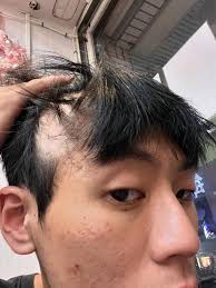 去渡假曬曬太陽不但可以放鬆，還能補充維他命D