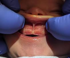 Image result for Lip Exam