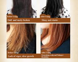 Strands can break easily and scalp can appear to be very itchy. Meiking Hair Treatment Mask Brand Chinese Herbal Conditioners Dry Damage Hair Repair Treatment Nutrition Hair Mask 20g 5pcs Lot Mask Sheet Hair Accessories Hello Kittymask Movie Aliexpress