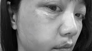 林男暴打高嘉瑜！母喪贈花名單曝全都是大咖| EBC 東森新聞| LINE TODAY