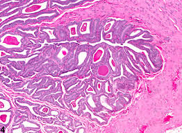 Image result for Seminal Vesicle