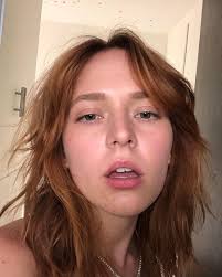 Real👏🏻Girls👏🏻Have👏🏻Clogged👏🏻Pores👏🏻