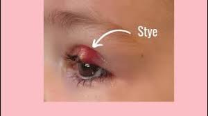 Image result for Styppeiochloa