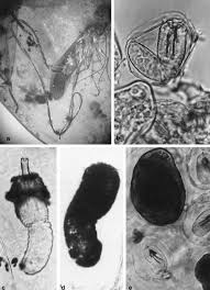 Parasitic horsehair worms primarily target invertebrates like insects but scientists believe that the worms are increasingly becoming a concern for studies documenting the risk of horsehair worms infecting humans have been published recently and the results are more than a little disconcerting. Nematomorpha An Overview Sciencedirect Topics
