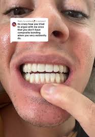 Orlando James Fake Teeth