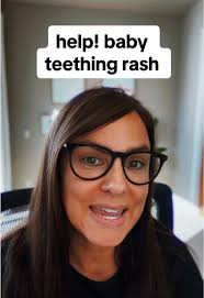 Bby Teething Red Face