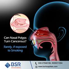 Be it the steroid therapy that. Bsr Ent And Eye Hospitals Hyderabad Or Secunderabad