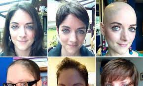 If you've recently finished chemotherapy, you may be eager grow your hair back. My Hair Journey After Chemotherapy Woman 31 Makes Timelapse Video Of 18 Months Of Hair Growth After Treatment For Breast Cancer Daily Mail Online