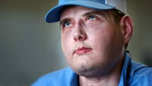 Face transplant gives Mississippi firefighter new lease
