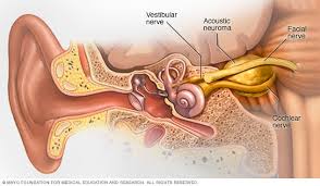 Many problems can explain voice change, but for patients with lung cancer, involvement of the left recurrent the left recurrent laryngeal nerve is especially prone to being cut off by lung cancer when it has spread to regional lymph nodes (in the mediastinum; Brain Tumor Symptoms And Causes Mayo Clinic