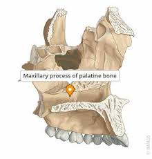 Image result for Maxillary Bone