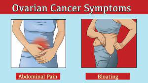 Persistent bloating is one of the main signs of ovarian cancer, yet research has shown that only a third of women in the uk would go to their doctor if they were experiencing this potential. 5 Symptoms Of Ovarian Cancer Womenworking