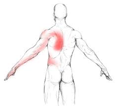 M Latissimus Dorsi Schmerzen Und Triggerpunkte Selbst Behandeln