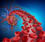 The Crucial Difference Between Hypovolemic and Hemorrhagic ...