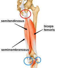 In human anatomy, a hamstring is any one of the three posterior thigh muscles in between the hip and the knee. Proximal Hamstring Injury Robert Howells