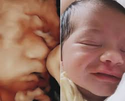 ✨ Ver o bebê antes de nascer é uma experiência que nenhuma gravidinha  esquece. Mas ver o rostinho dele depois e perceber que já reconhecia  aqueles traços… é simplesmente emocionante. 💖👶 A