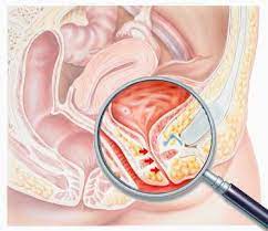 Aber trotz orgasmusgefühls „kommt das ejakulat nicht aus dem penis heraus. Vom G Punkt Bis Zum Squirting Netdoktor At