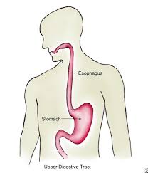 The two main types of esophageal cancer are squamous cell carcinoma (which starts in the cells of the lining) and adenocarcinoma (which starts in the tissue that helps you swallow). Esophageal Cancer Ncis National University Cancer Institute Singapore