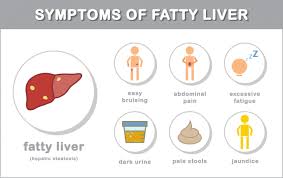 Symptoms Of Fatty Liver Disease Fatty Liver Disease Symptoms Fatty Liver Fatty Liver Diet