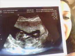 Pin On Ultrasound Notes