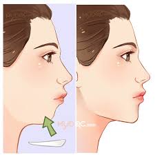 Come in, learn the word translation dagu and add them to your flashcards. Top 5 Chin Implants In Malaysia Price Guide Reviews