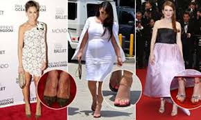Submitted 1 year ago by pleasedontfollowm3. Kim Kardashian S Swollen Feet And Julianne Moore S Crippled Toes The Worst Celebrity Foot Faux Pas Daily Mail Online