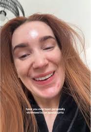 Support Group for Aperol Spritz Victims