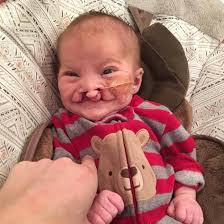 Con bị dị tật nhưng nhất quyết giữ đến cùng, nhiều tháng sau, người mẹ nhận  được một thứ khiến cô rơi nước mắt