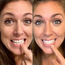 Utah Bright Smiles- formerly Art Design Dental