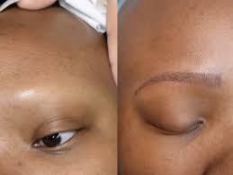 The common and even unnoticeable eyebrow tattoo is the kind that women get as permanent. Eyebrow Tattoos Are Helping People With Hair Loss