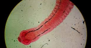 Image result for Beef Tapeworm