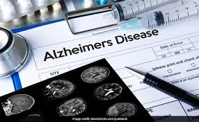 Continued approval for aduhelm's indication as a treatment for alzheimer's disease may be contingent upon verification of clinical benefit in confirmatory trial(s). Hjoxzv Qlsfedm
