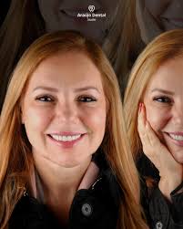 Leonidas Munhoz Araujo Filho (@leonidas.f) • Instagram photos and videos