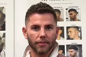 I'm A Celeb star Dean McCullough's four-figure hair transplant before  jungle adventure