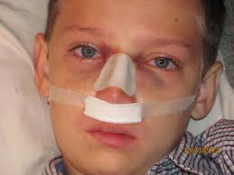 Anyone else having problems with Stemmers Run Middle? My son within the  first month of school has his nose broke by another student during first  period. The school never called me and