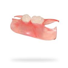 Because every patient's situation is unique, the cost of dental extractions and other surgical procedures is separate from the cost of the dentures. Flexible Partial Dentures Cost Types European Dentures