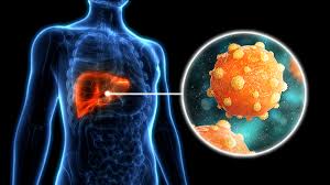 Image result for hepatitis symptoms