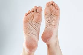 This post may lead to extended periods of wanking! Old Woman Feet Stock Photos And Images 123rf