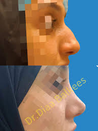 Dr. Diaa Balkees دكتور ضياء بلقيس‎ (@dr.diaabalkees) • Instagram photos and  videos