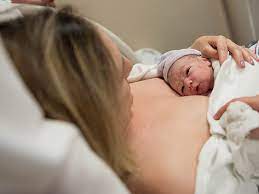 Delayed Cord Clamping Benefits Risks And Recommendations