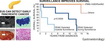 Pancreatic cancer is the most aggressive, least treatable form of the disease, and in a large majority of cases it reduces the victim's life expectancy to a matter of months. Risk Of Neoplastic Progression In Individuals At High Risk For Pancreatic Cancer Undergoing Long Term Surveillance Gastroenterology
