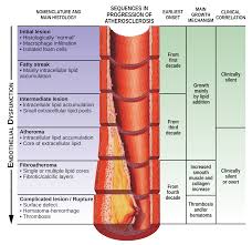 動脈粥狀硬化- 維基百科，自由的百科全書