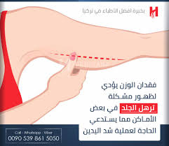اعرف أكثر عن عمليات شد اليدين في تركيا اسطنبول الفريق الطبي يرحب بالاجابه على جميع استفساراتكم Wha Plastic Surgery Kingdom Of Great Britain Hair Clinic
