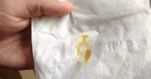 We did not find results for: Keluar Flek Coklat Di Usia Kehamilan 8 Minggu Puput Mutiara