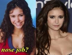 She is dating american actor adrien brody. Elsa Pataky Plastic Surgery Before And After Fact Or Rumor Plastic Surgery Hits