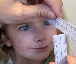 Managing Binocular Vision and Pediatric Eye Conditions